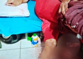 Homem com deficiência é vítima de bala perdida em Governador Valadares.