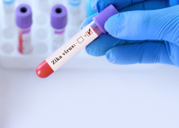 Lula autoriza R$ 60 mil a crianças com deficiência por zika