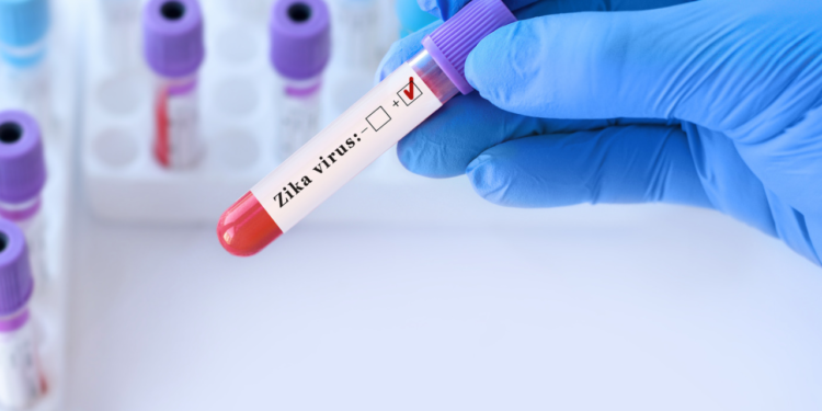 Lula autoriza R$ 60 mil a crianças com deficiência por zika