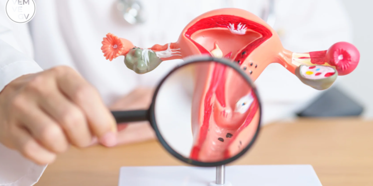 Saúde da Mulher em Foco: Campanha Março Lilás segue em Valadares