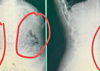 Presos tentam voltar da ‘saidinha’ com drogas no estômago em Valadares