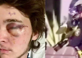 Em protesto contra o ICE, manifestante fica cego por disparo de agente