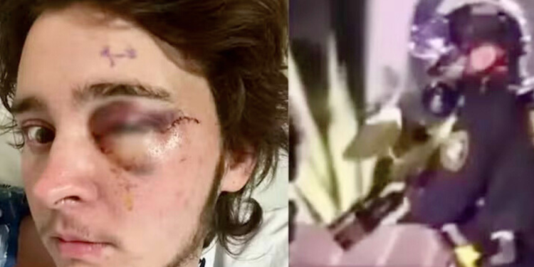 Em protesto contra o ICE, manifestante fica cego por disparo de agente