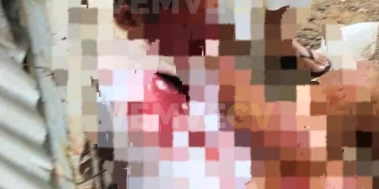 Homem é atacado por três pitbulls em Valadares