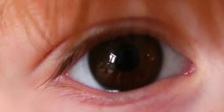 GV Shopping recebe campanha ‘De Olho nos Olhinhos’