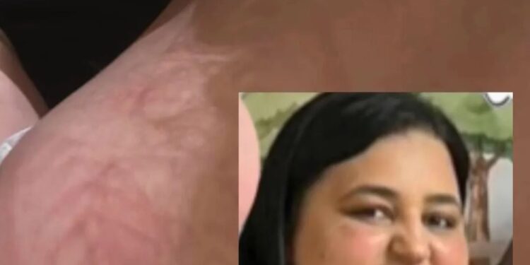 Babá acusada de agredir criança em Massachusetts EUA, foge para o Brasil