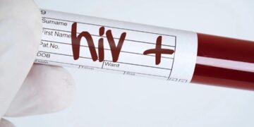 Seis transplantados do RJ testam positivo para HIV após receberem órgão infectado