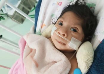 Família de Laura, bebê com microcefalia, pede ajuda para tratamento especializado em Valadares