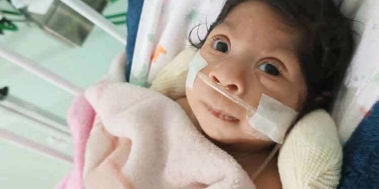 Família de Laura, bebê com microcefalia, pede ajuda para tratamento especializado em Valadares