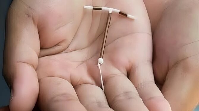 Nove unidades de saúde são referência para colocação de DIU, em Valadares