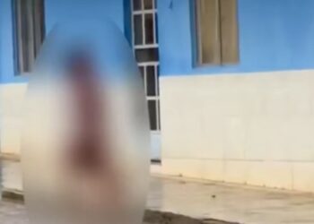 Mulher é atacada pelo companheiro e leva 12 facadas